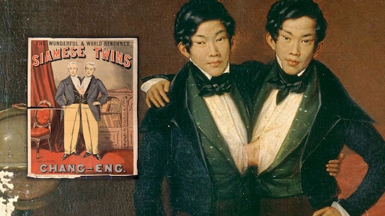 The Brothers Who Inspired the Term “Siamese Twins”